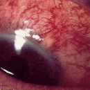 아이메디케어 이미지