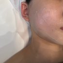로자벨호텔 | 천안 성성동 피부관리샵 이야에스테틱 동안 윤곽관리 후기