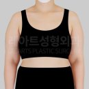 닥터정앤박날씬의원 | 완벽한 웨딩 드레스 핏의 완성은 '팔 라인'입니다. [닥터's 노트 by.서용승 원장]