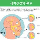 삼차신경통 및 진단 (3차신경통 오른쪽 왼쪽 얼굴통증, 씹을때통증 치통) 이미지