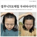정수리탈모 예방 모제림 두피앰플 셀루닉 헤어미라클 두피마사지기 (12주 사용 솔직 후기)