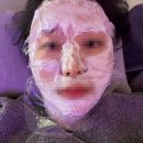 600 | [청담] 울쎄라 프라임 + 써마지 각 600샷 후기/(통증, 효과 시기)