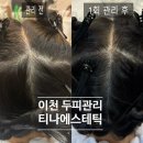 티나 에스테틱 이미지