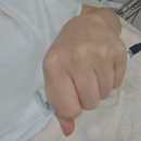 임서영에스테틱 | 전주효자동피부관리 임서영에스테틱 아쿠아필 후기
