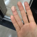 황지모한의원 | 과민성 대장 증후군 ; 반포 황지모 한의원 내돈내산 후기