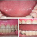 우리들치과기공소 이미지