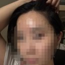 [잠실 무드문브로우] 잠실반영구 맛집 M자이마 탈출 헤어라인