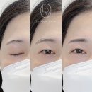 구리눈썹문신 러비듀에서 자연스럽게 예뻐진 썰