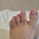 유어짐 토탈 휘트니스 | 다이소 문제성손발톱 케어, 링링유어솔루션클리어케어 + 토탈앰플 사용 후기!