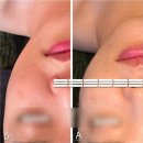 셀럽 뷰티어겐 | 은평구피부관리 응암피부관리 얼굴광채 미백관리 셀럽뷰티어겐 대만족 후기