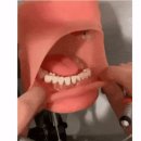 치과의사에서 원하는모양 입벌리기 이미지