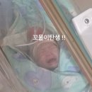[ 출산일기 ] 제왕절개 D-1 입원 , 그리고 D-day 꼬물이 세상밖으로 나온날