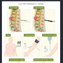 복합부위통증증후군 증상과 유발인자 이미지