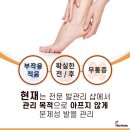 레푸스 화정점 네이버블로그