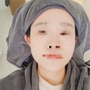 배럴스두피탈모센터 이미지