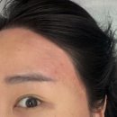 새라뷰티 | 대구 헤어라인 왁싱 잘하는 곳 ㅣ 새라뷰티 신월성점 후기 (잔머리 정리 대박)