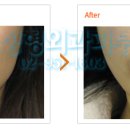 제이케이성형외과의원 이미지