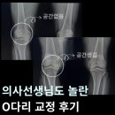탄현 동물병원 | 탄현 헬스 의사선생님도 놀란 O다리 체형교정 후기
