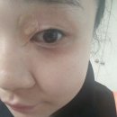 최윤정피부과의원 네이버블로그