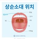 경북도청 리더스 치과의원 | 11개월 아기 쿠쿠 상순소대 찢어짐 😭