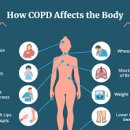 만성 폐쇄성 폐 증세 원인 낫는법제 (COPD) 이미지