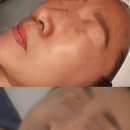 터치피부샵 이미지