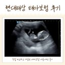 현대해상 태아보험, 설계사 10명 비교 후 내돈내산 가입 후기