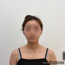 위드미 포항양학점 | 포항피부관리 신부관리 목·어깨 뭉침까지 풀린 벨루위드미 두피해독&amp;리프팅 관리 솔직후기