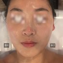 비전3로 | 평택 비전동피부관리 추천 : 봄날에스테틱 경락 후기 (소사벌 피부관리)