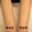 뷰티셀렉션미 | 대전 왁싱샵 추천 봉명동 뷰티셀렉션미 팔 왁싱 후기