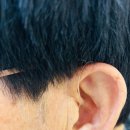 포낙보청기포항센터 | 포낙보청기 노원센터에서 맞춘 포낙인피니오 착용 후기