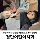 울들치과의원 | 검단 어린이 치과 영유아구강검진 이흔들림
