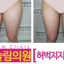 메디벤트 이미지