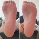 로제네일 이미지