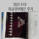 최세미산부인과 | 임신 23주 , 자궁경부무력증 눕눕생활 후기