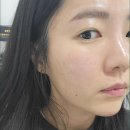 B&B에스테틱 네이버블로그