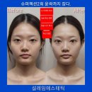 “부산 슈퍼젝션 후기｜조카 인생 첫 ‘피부 예쁘다’ 소리 듣게 해준 곳”다대동피부관리실