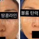 이쁜 피부 부탁해