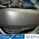 덴트존 이미지