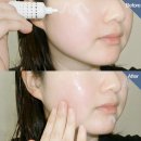 이에스메디칼 | DN64 슈퍼 리바이브 재생크림 MTS 시카크림 더마크림