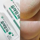 동성약국 | 발각질제거 신신제약 유라덤크림 (우레아) 약국발각질템 내돈내산 후기! 발각질크림 풋크림 추천