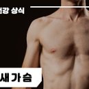 여자 남자 새가슴 원인 및 증상과 치료 교정 : 오목가슴 이미지