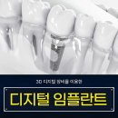 동암역 임플란트 전문 치과 잘하는 곳 List 추천 6곳
