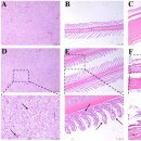 문치가자미 (Pseudopleuronectes yokohamae)의 피부 궤양 원인균 Vibrio splendidus 이미지