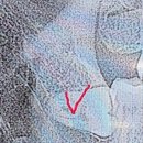 서울이턱사랑니치과의원 이미지