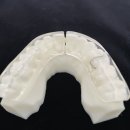 리라소프트 | 이갈이 스플린트 효과, 부작용 없이 200% 얻는 방법