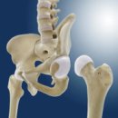 통증 시리즈 HIP IMPINGEMENT SYNDROME 세미나 안내 이미지