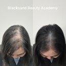 블랙샌드뷰티 이미지