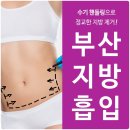 광안카클리닉 | 부산지방흡입가격 아깝지 않은 곳