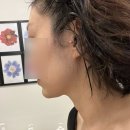 아르드뽀에스테틱 나성동기계관리 고급진탄력관리 받은 내돈내산 찐후기